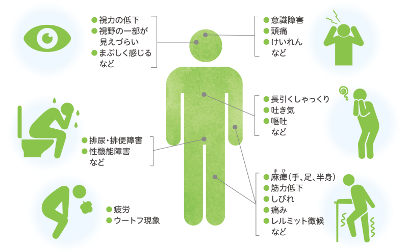 NMOSDを発症すると、視力の低下、視野の一部が見えづらくなる、意識障害や頭痛など、さまざまな症状があらわれます